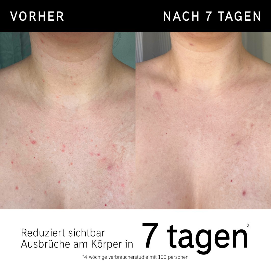 Скраб для тела peeling-stift für den körper mit glykolsäure The Inkey List, вес 45 гр. — фото 2