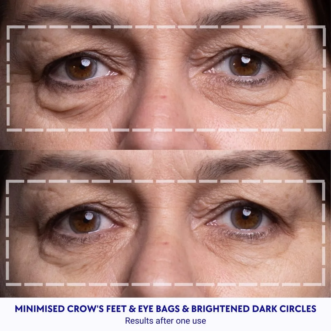 Wrinkles Schminkles патчи от морщин под глазами, разглаживают морщины, гусиные лапки и темные круги за ночь, 6 пар многоразовых медицинских силиконовых патчей для сна — фото 3