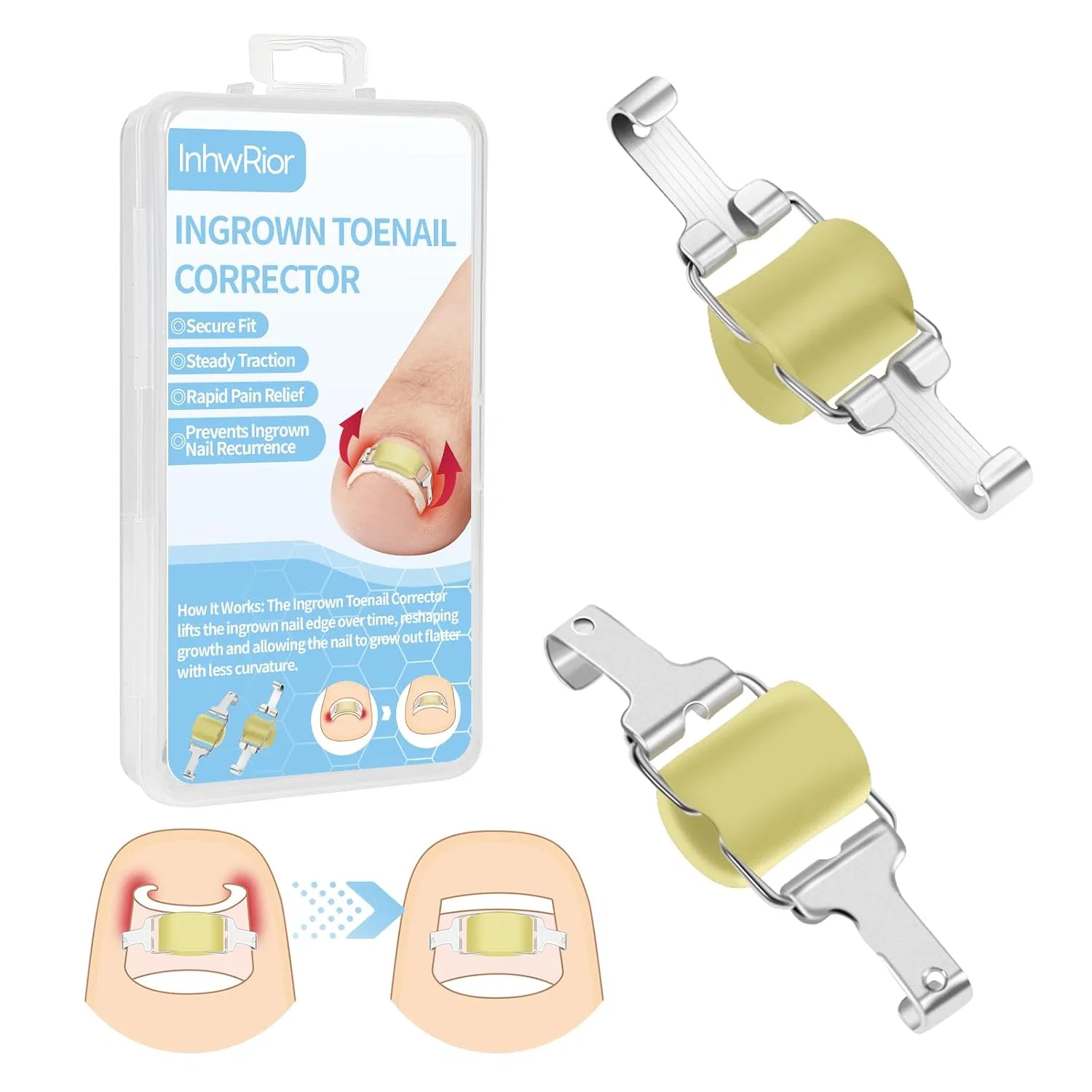 Корректор вросшего ногтя от Ingrown Toenail Correctionary Inhwrior
