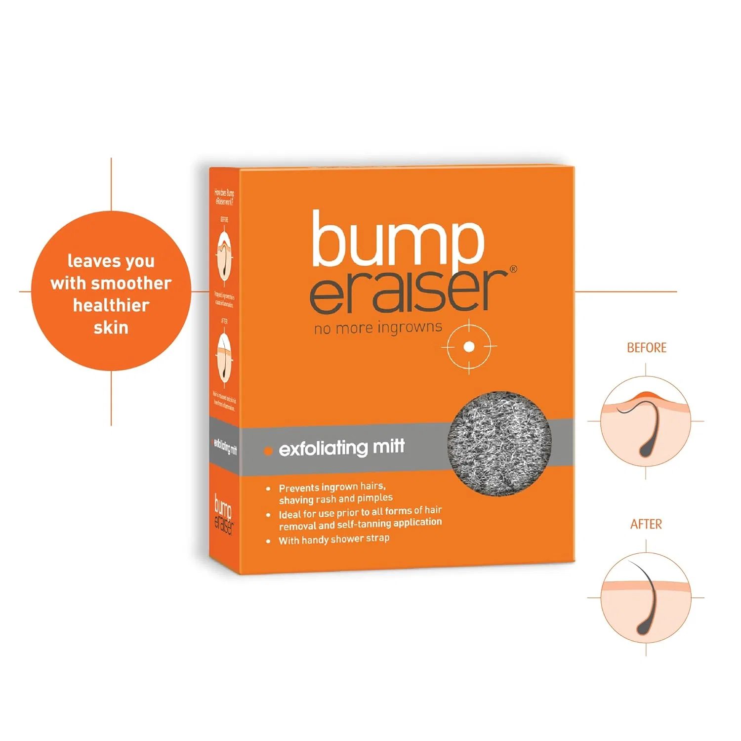 Отшелушивающая перчатка «bump eRaiser» для тела ‎Bump Eraiser — фото 3