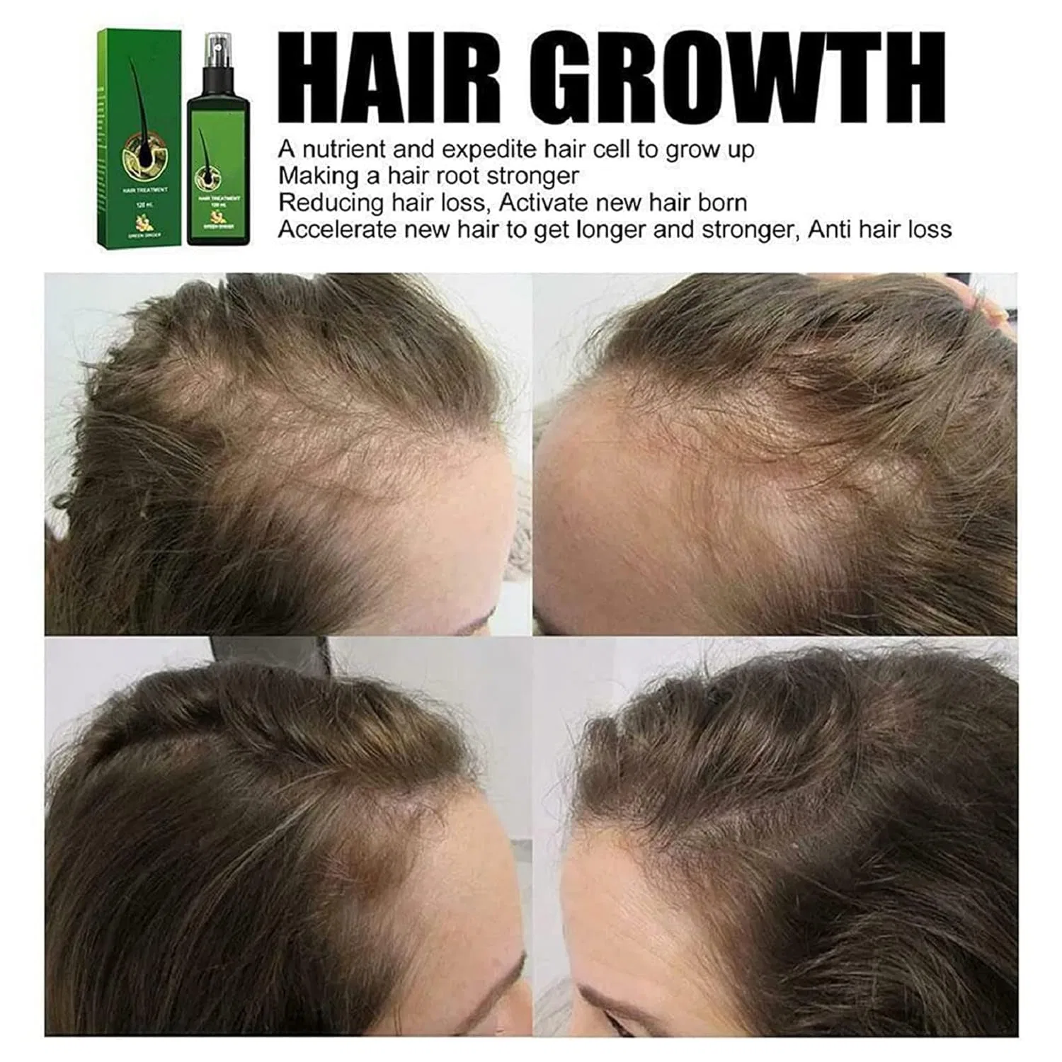 Сыворотка для роста волос Nourishing Ginger Spray, 2 шт. Zrremre, Set Of 2 — фото 3