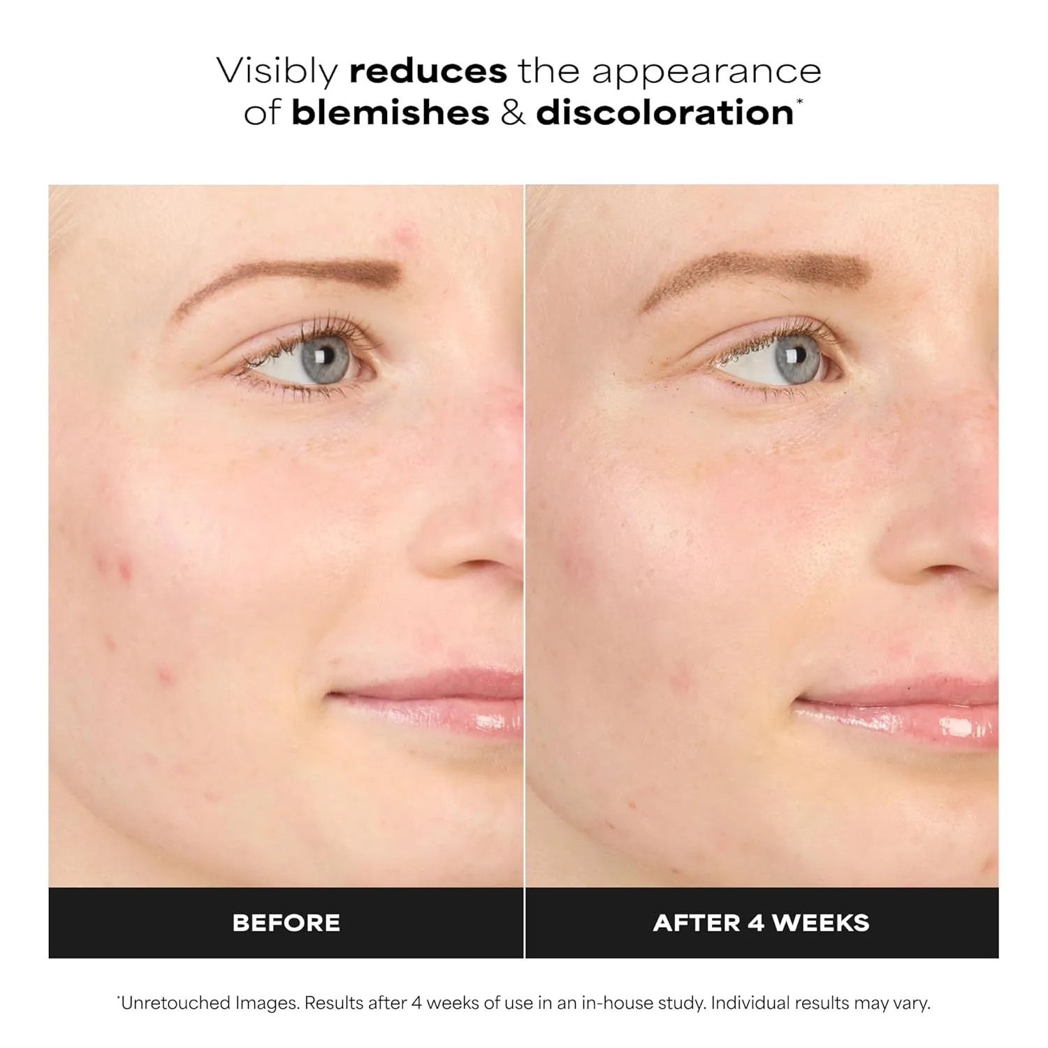 Бустер Paula's Choice — BOOST % Azelaic Acid Booster Cream Gel Face Serum with Salicylic Acid, Oil-Free Skin, 29.6 мл — фото 3