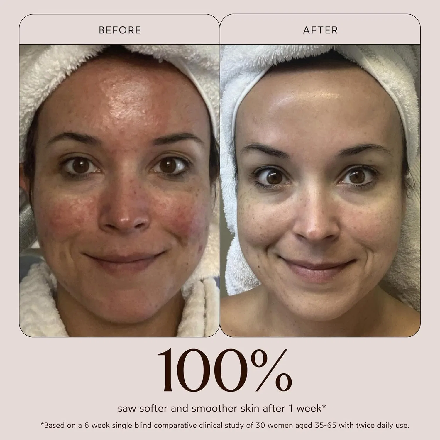 Сыворотка True Botanicals — Натуральная активная «Chebula Active Serum» от — фото 4