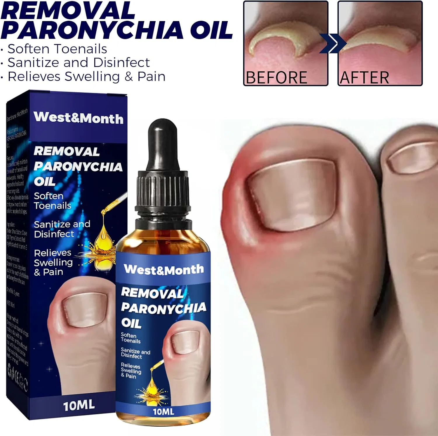 Масло для ногтей Toenailplus Anti Paronychia Relief Oil Lwuuywa — фото 2