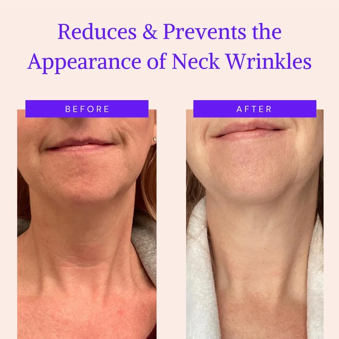 Силиконовые патчи от морщин для шеи Anti-Wrinkle Pads Blumbody — фото 2