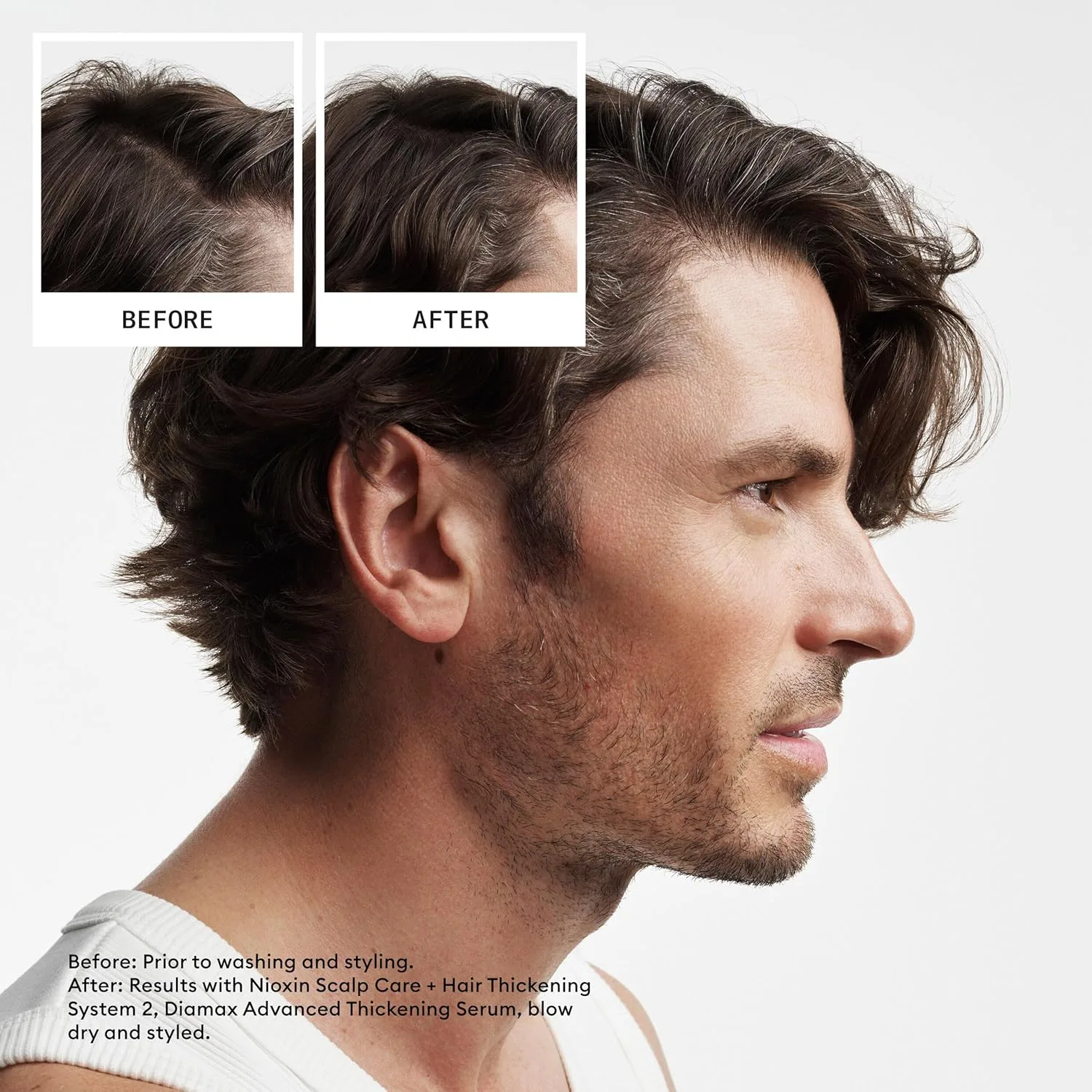Кондиционер Nioxin Scalp + Hair Thickening System 2 | Для натуральных или необработанных волос с прогрессирующим истончением | С ниацинамидом и биотином | 950 мл 1000 мл (.) — фото 2
