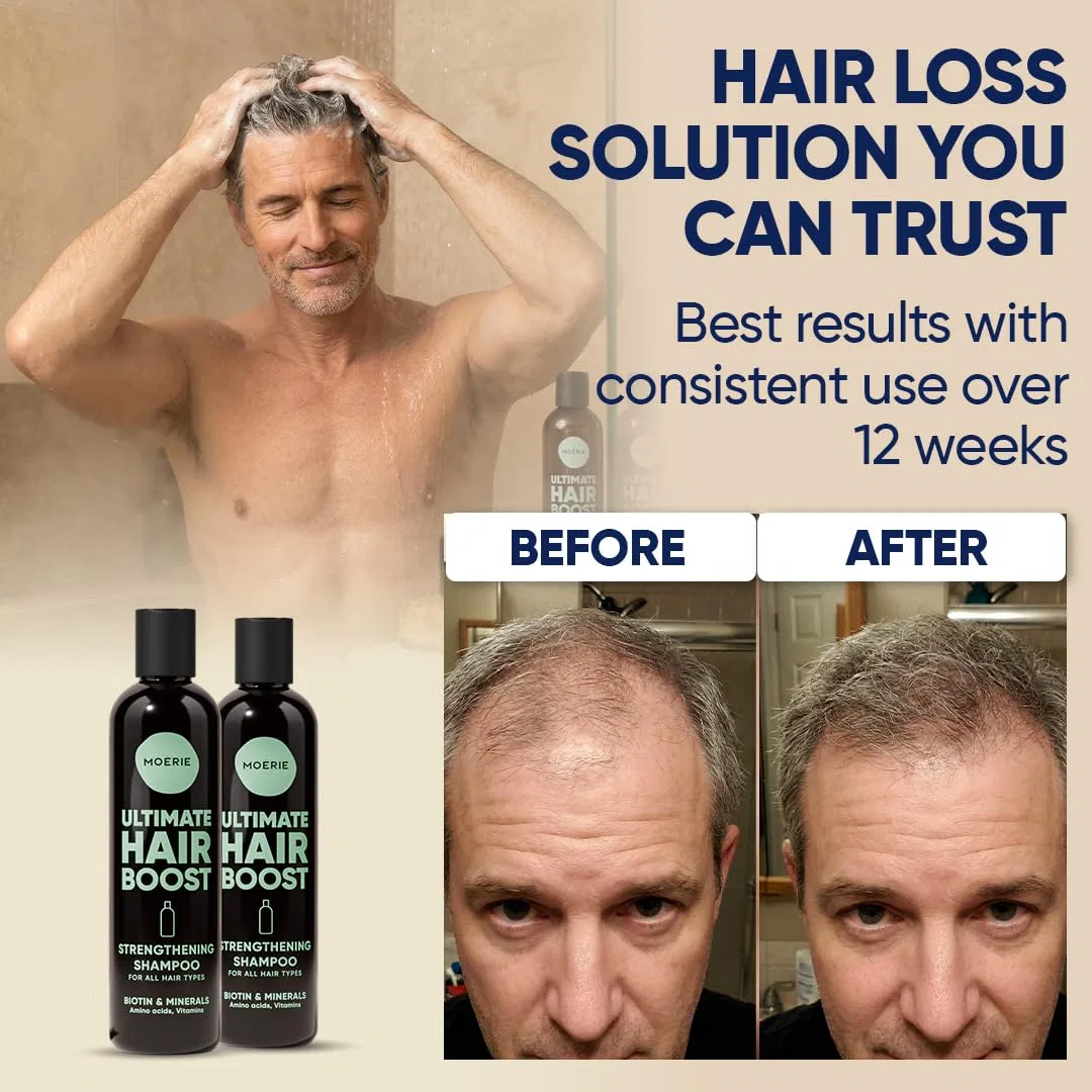 Шампунь для роста волос с биотином и кофеином Moerie, Single Set Shampoo — фото 4