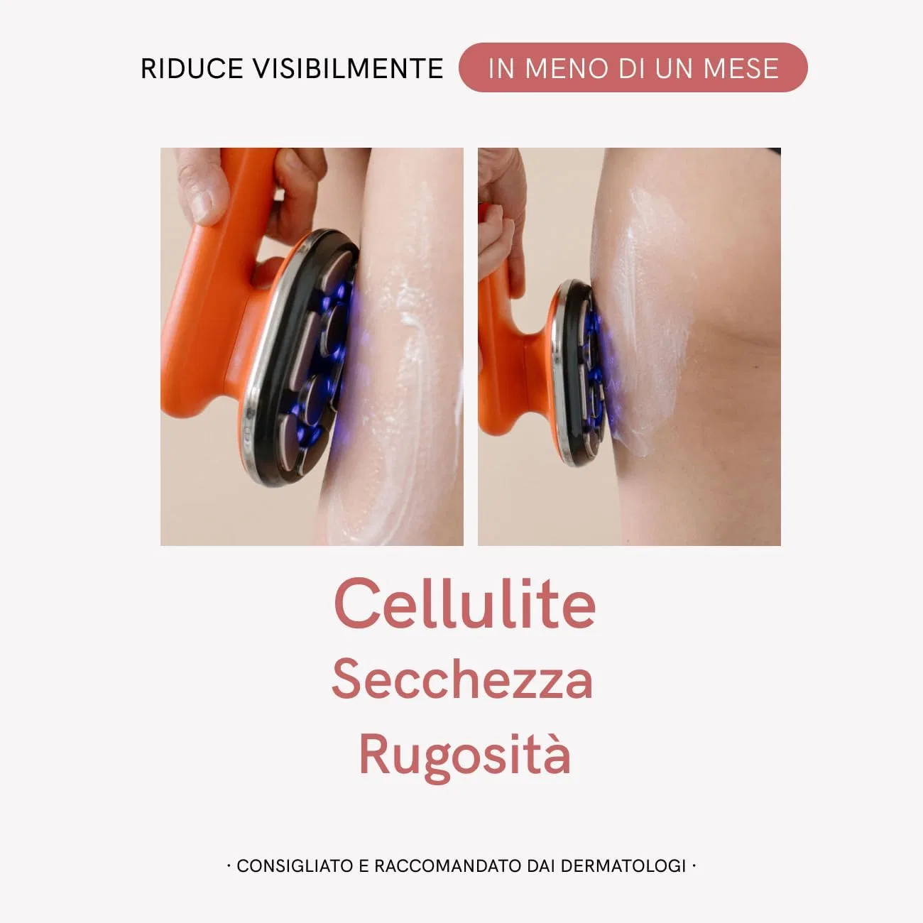 Набор MASDERM Cellulite Kit 2 в 1: радиочастотный прибор и антицеллюлитный крем 500 мл Masderm, Pack_Celulitis_Crema_Aparato_2024 — фото 2