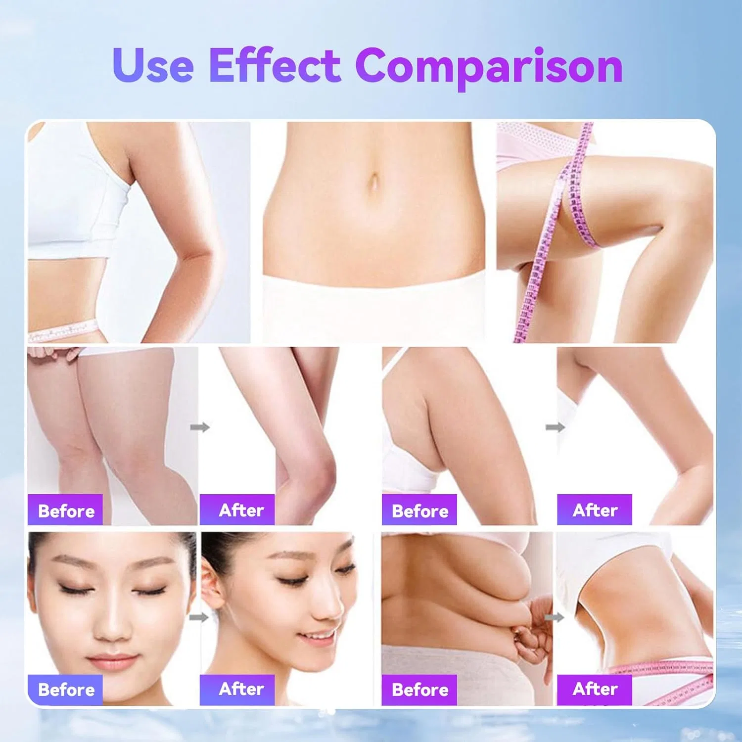 Многофункциональный массажер для тела 4 в 1 40K Slimming Device Uoeonr — фото 4