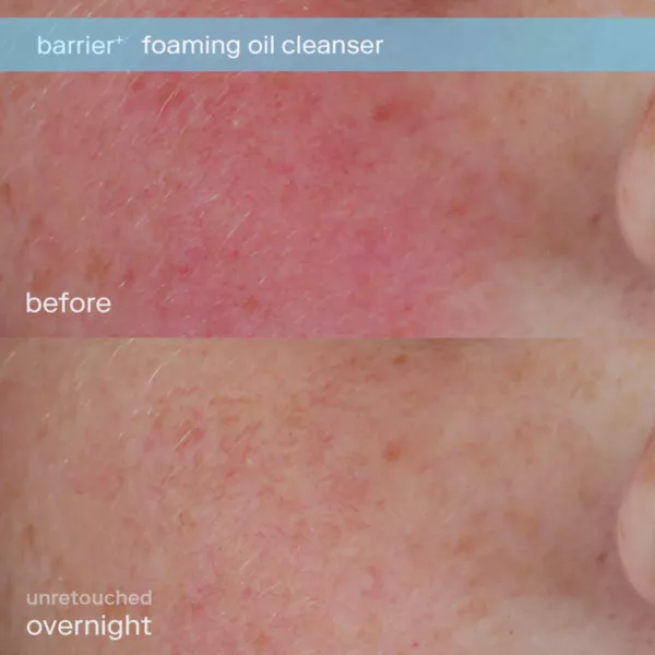 Молочко для умывания Skinfix — Barrier+ пенящееся увлажняющее очищающее масло — фото 2