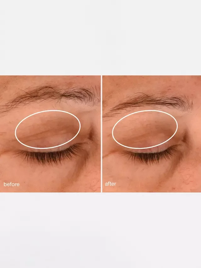 Крем для глаз Phyto Nature Lifting Eye Cream, 15 мл Dermalogica — фото 4