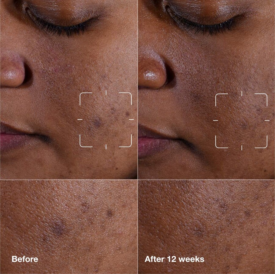 Сыворотка для осветления темных пятен Even Better Clinical с витамином С CLINIQUE, 1.7 oz /50 mL — фото 3