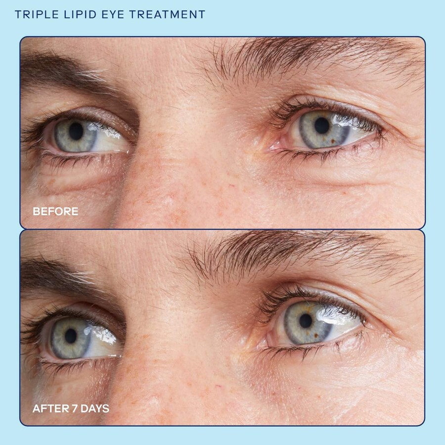 Крем для глаз barrier+ Triple Lipid Brightening Eye Cream Skinfix, 0.5 oz /15 mL — фото 3