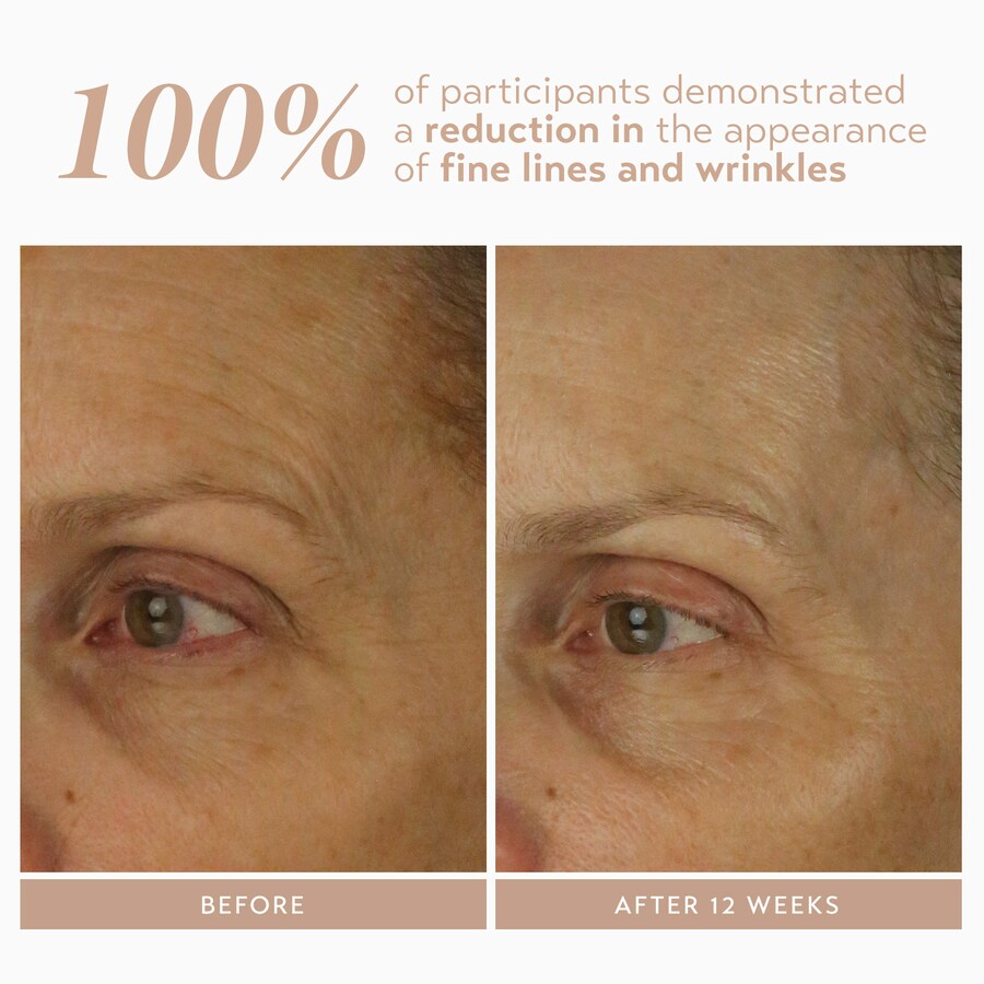Сыворотка Shani Darden Skin Care — Retinol Reform с % инкапсулированного ретинола для борьбы с мелкими морщинами — фото 3