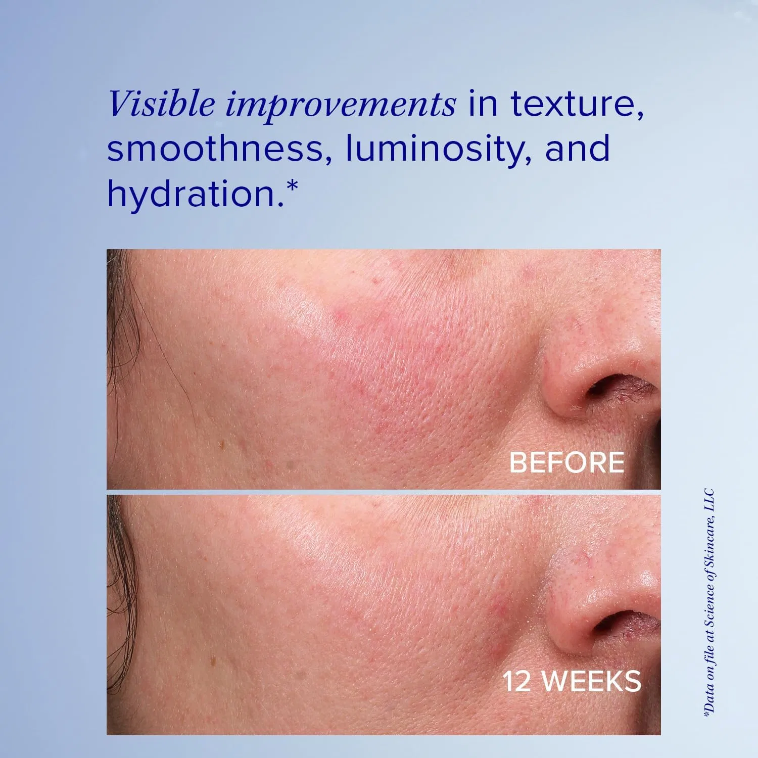 Сыворотка ретиноловая iS Clinical Retinol+ Emulsion 0.3, 28.35 г — фото 4