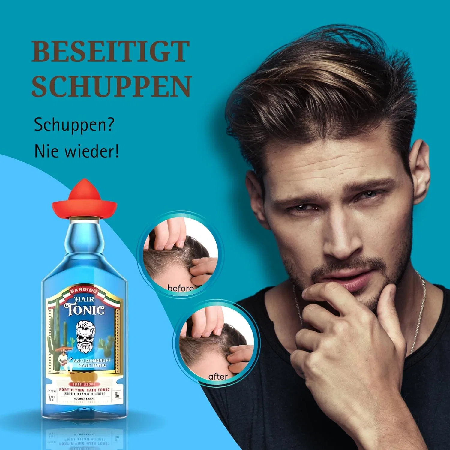 Тоник для волос против перхоти и выпадения «Anti-Dandruff» 250 мл от BANDIDO Bandido — фото 2