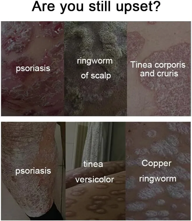 Крем для тела Care Cream IEPABY 20 г — фото 3