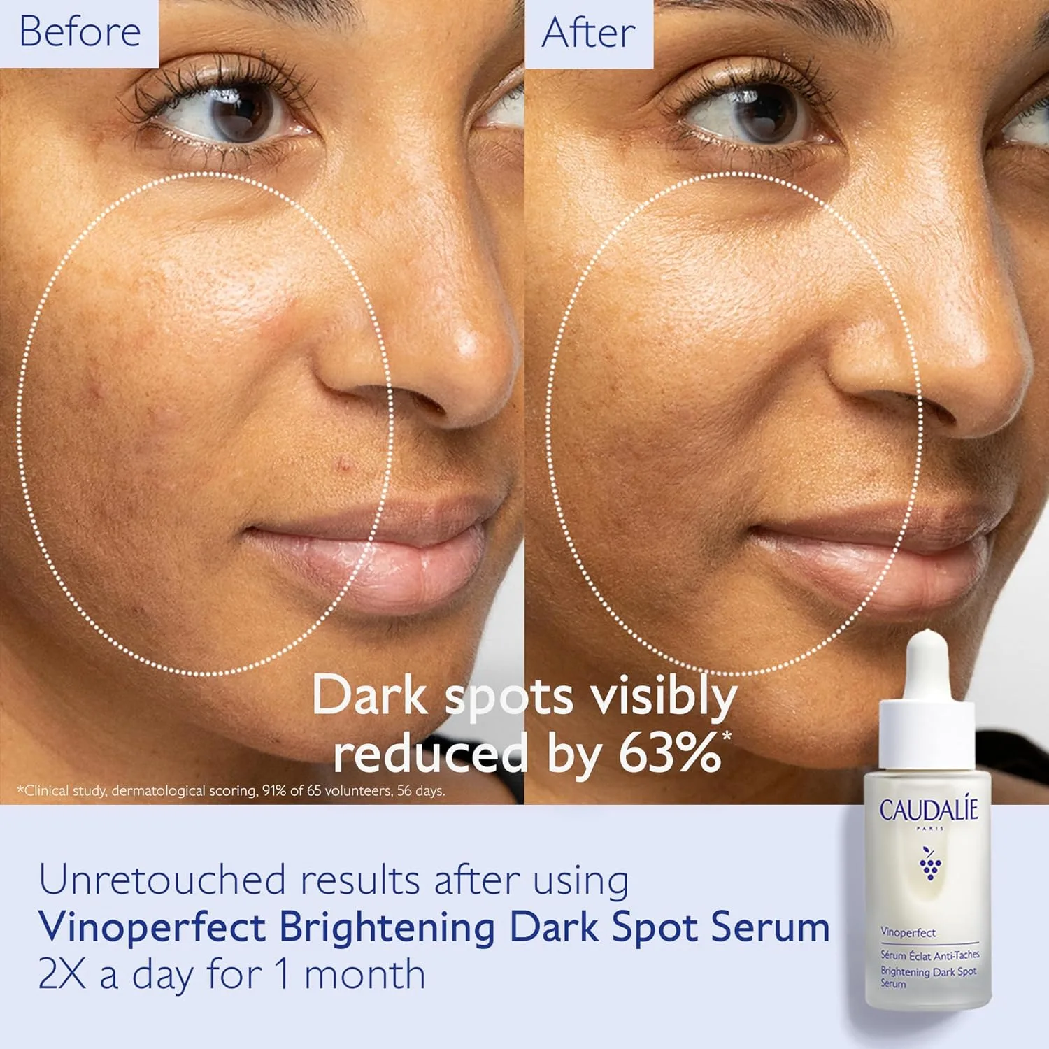 Осветляющая сыворотка для лица Caudalie Vinoperfect от темных пятен и спрей для лица с ароматом винограда в дорожном формате — фото 2