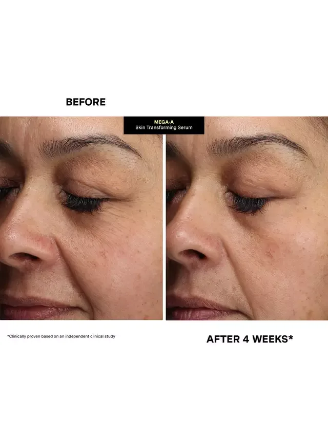 Сыворотка Kate Somerville — Для преображения сетчатки глаза Mega-A Retinal Skin Transforming Serum, 30 мл — фото 4