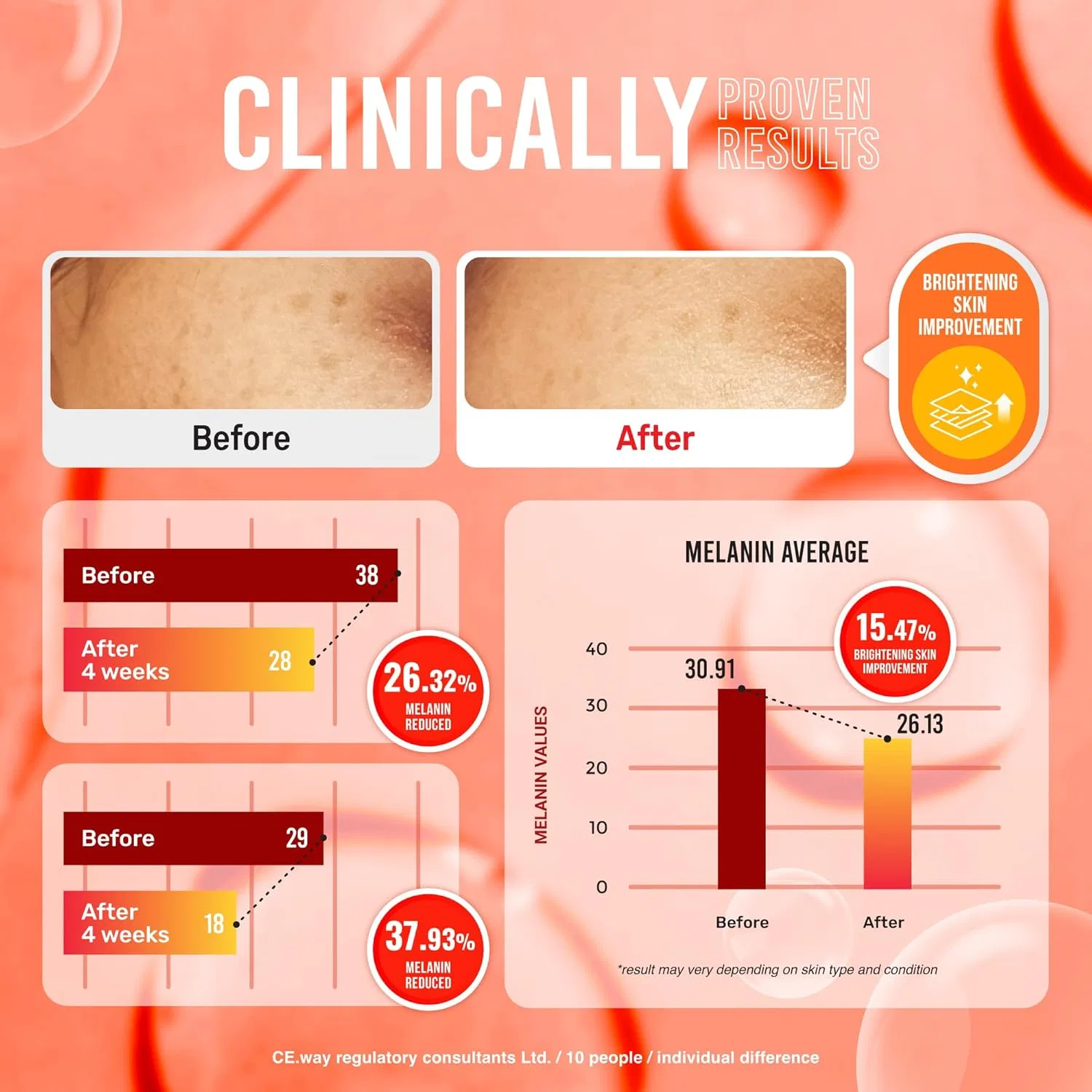 Осветляющее мыло с койевой кислотой «Pure Kojic Acid» от Koji White, 2.82 унции (2 шт.) Koji White — фото 2