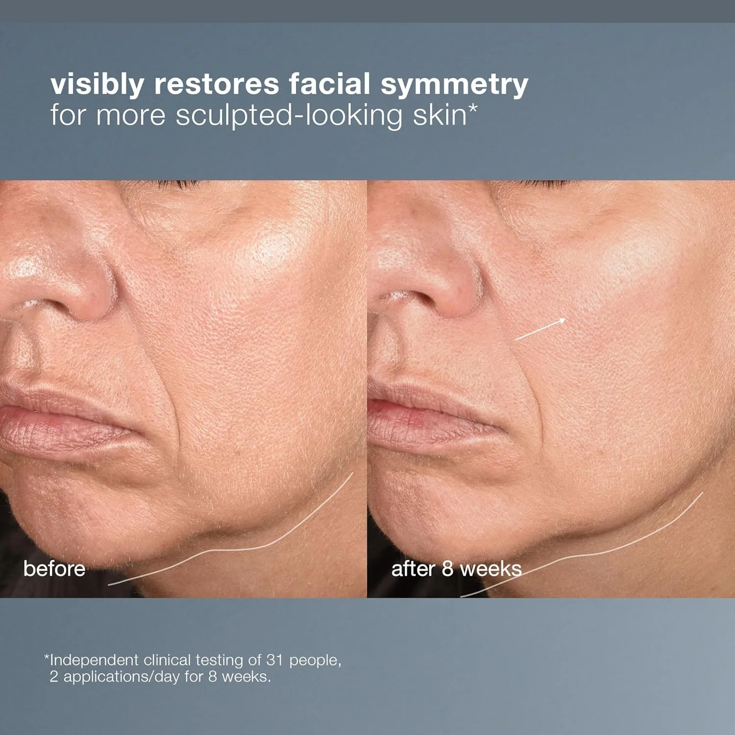 Сыворотка Dermalogica — Для лица NeuroTouch Symmetry Serum, питающая и восстанавливающая симметрию лица, 1 жидкая — фото 4