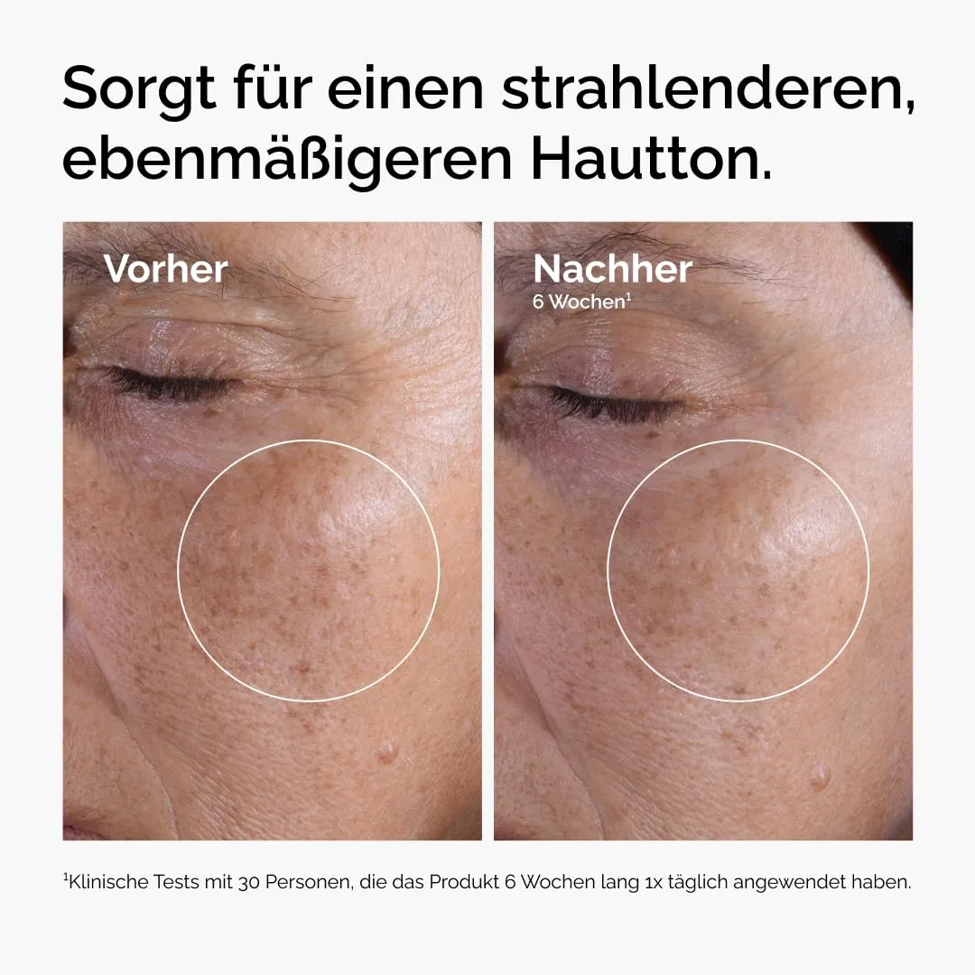 Тоник The Ordinary — Отшелушивающий «Glycolic Acid % Exfoliating Toner» от — фото 2