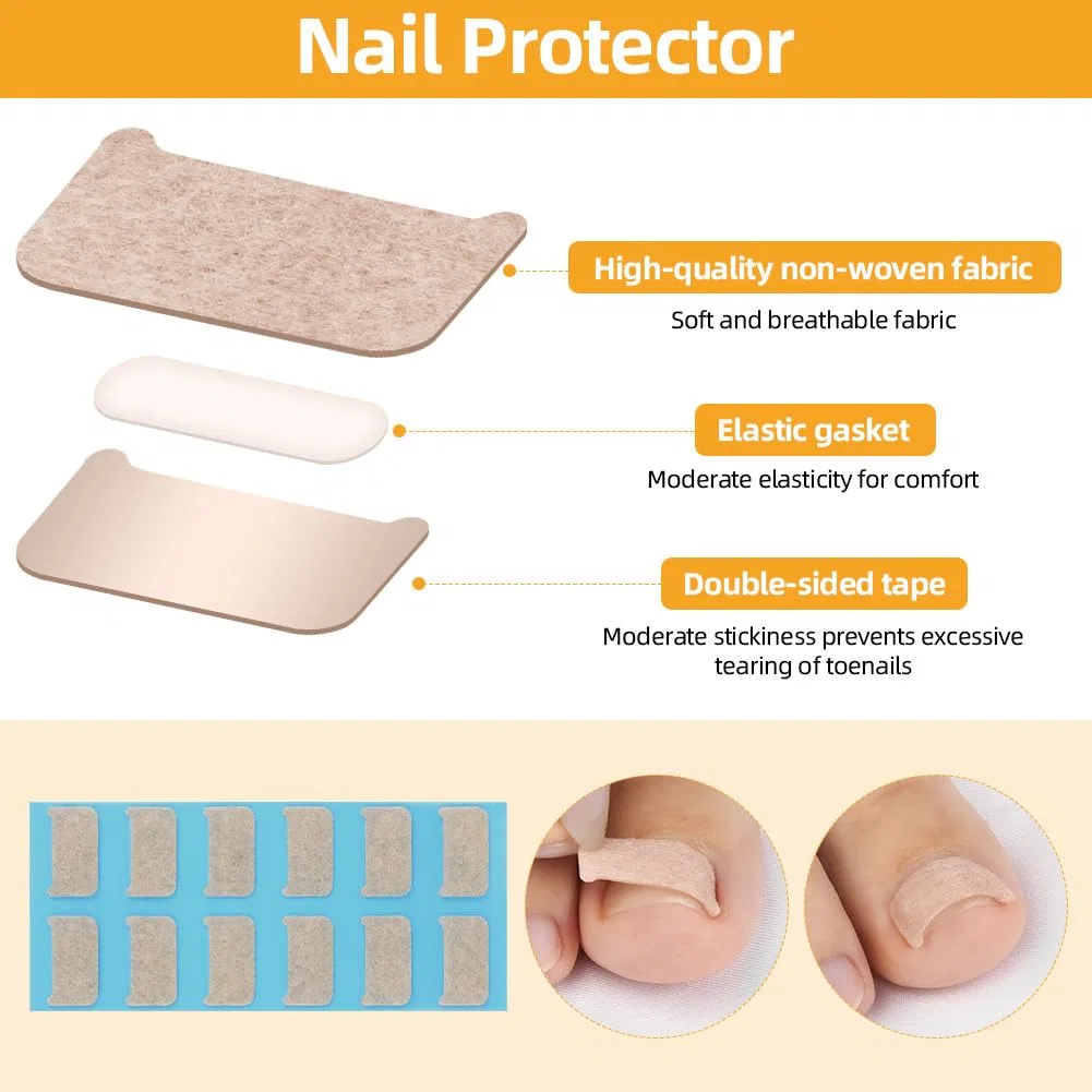Набор Beugo для вросших ногтей, 110 предметов ‎Beugo, 167 X Toe Nail Correction Plaster Set — фото 4