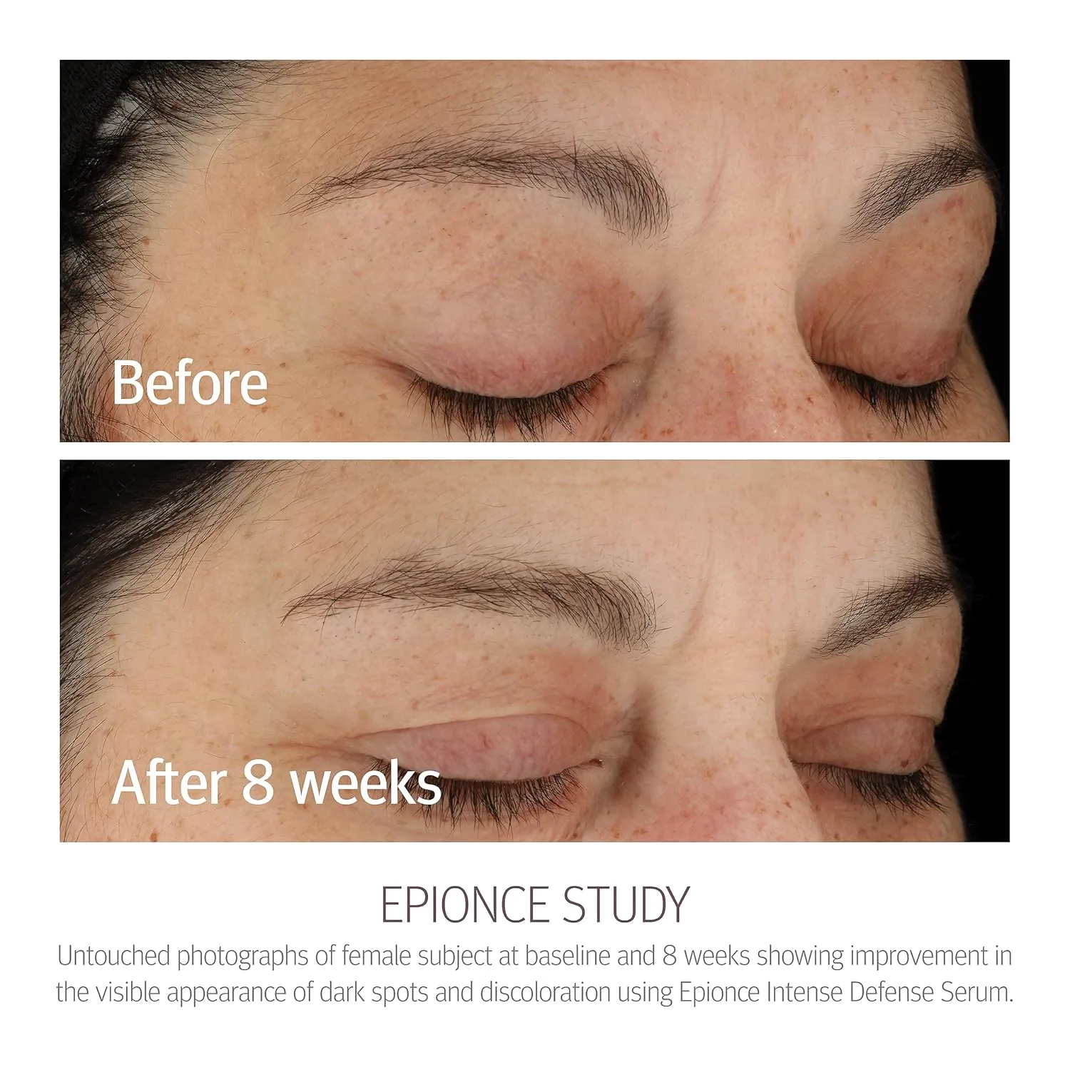 Сыворотка для лица Epionce Intense Defense Serum - антивозрастная сыворотка с витаминами C, E, D, A, B и ниацинамидом, разработанная дерматологами. — фото 3