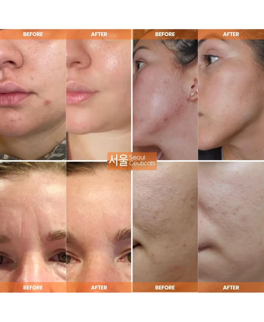 Крем для лица Seoul Ceuticals — Корейский многофункциональный антивозрастной восстанавливающий с экстрактом улиточной, 118 мл — фото 3