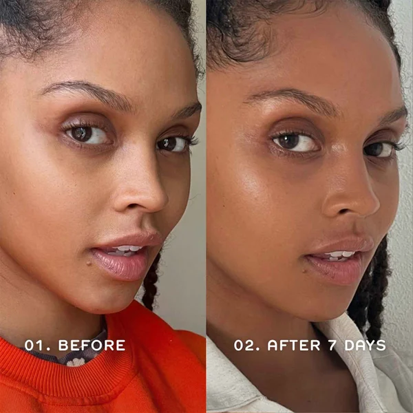Сыворотка Ren Clean Skincare — Для сияния и защиты, 30 мл — фото 3