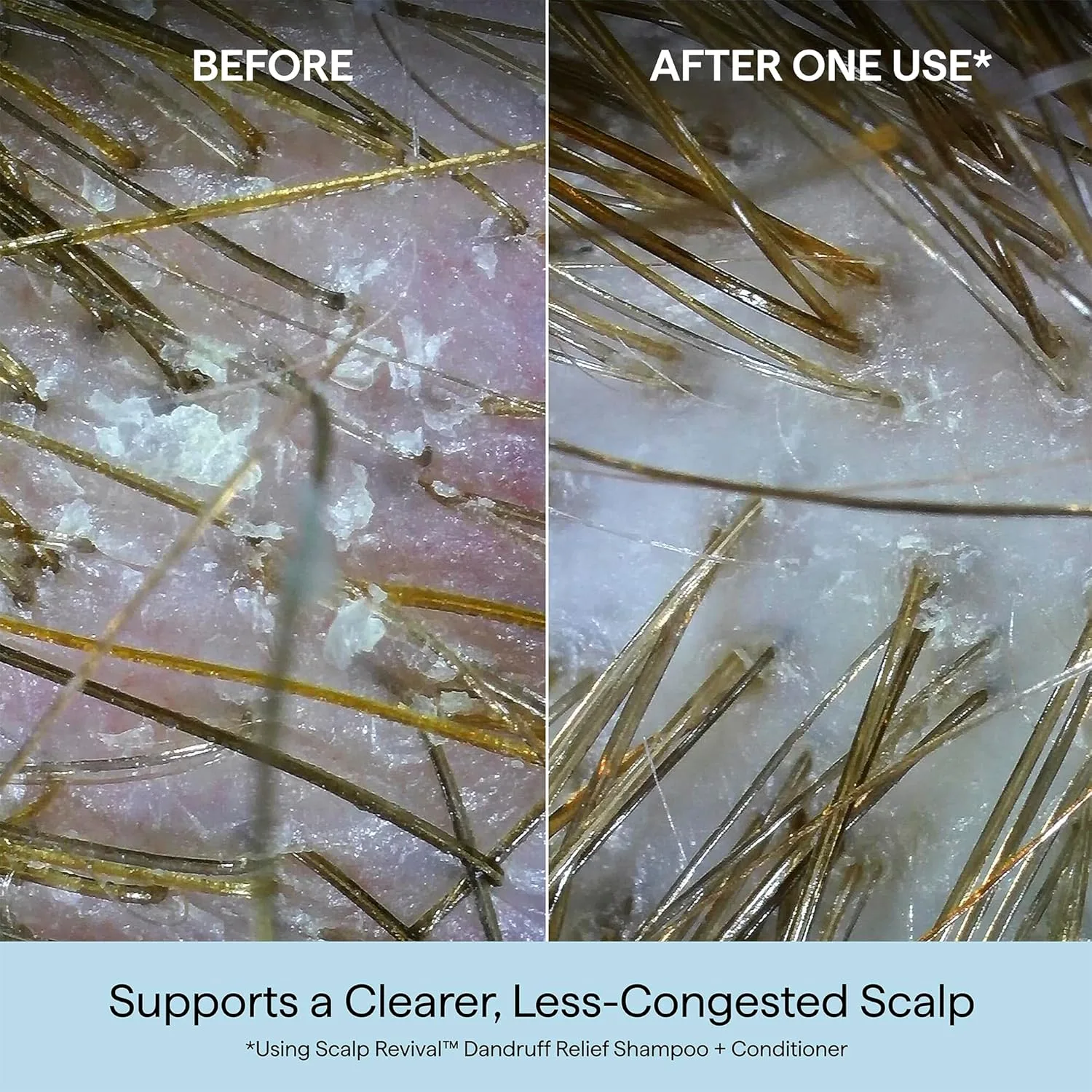 Briogeo Scalp Revival кондиционер против перхоти с древесным углем и 1, 8% салициловой кислоты, 250 мл — фото 2