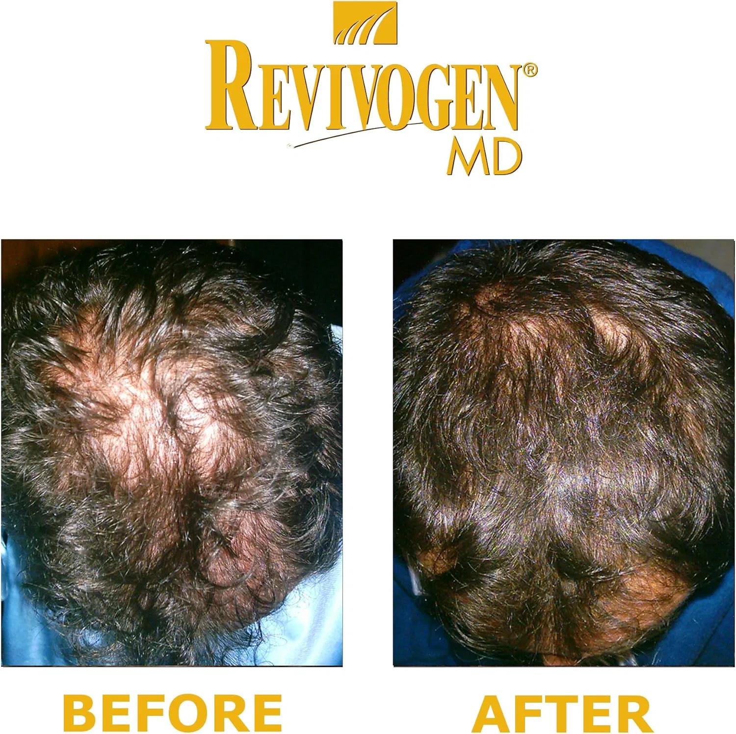 Средство для кожи головы REVIVOGEN MD Scalp Therapy для тонких и редеющих волос Revivogen — фото 3