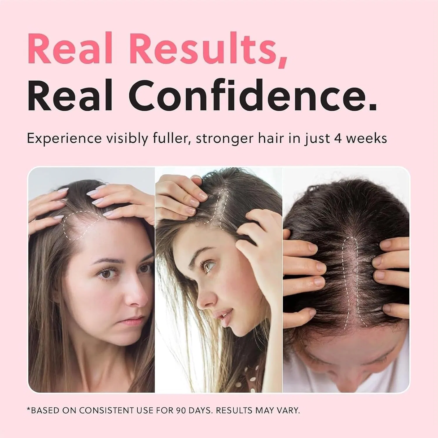 Спрей-масло для роста волос «Advanced Hair Growth Oil» без гормонов Soumiey, 2 Pieces. — фото 3