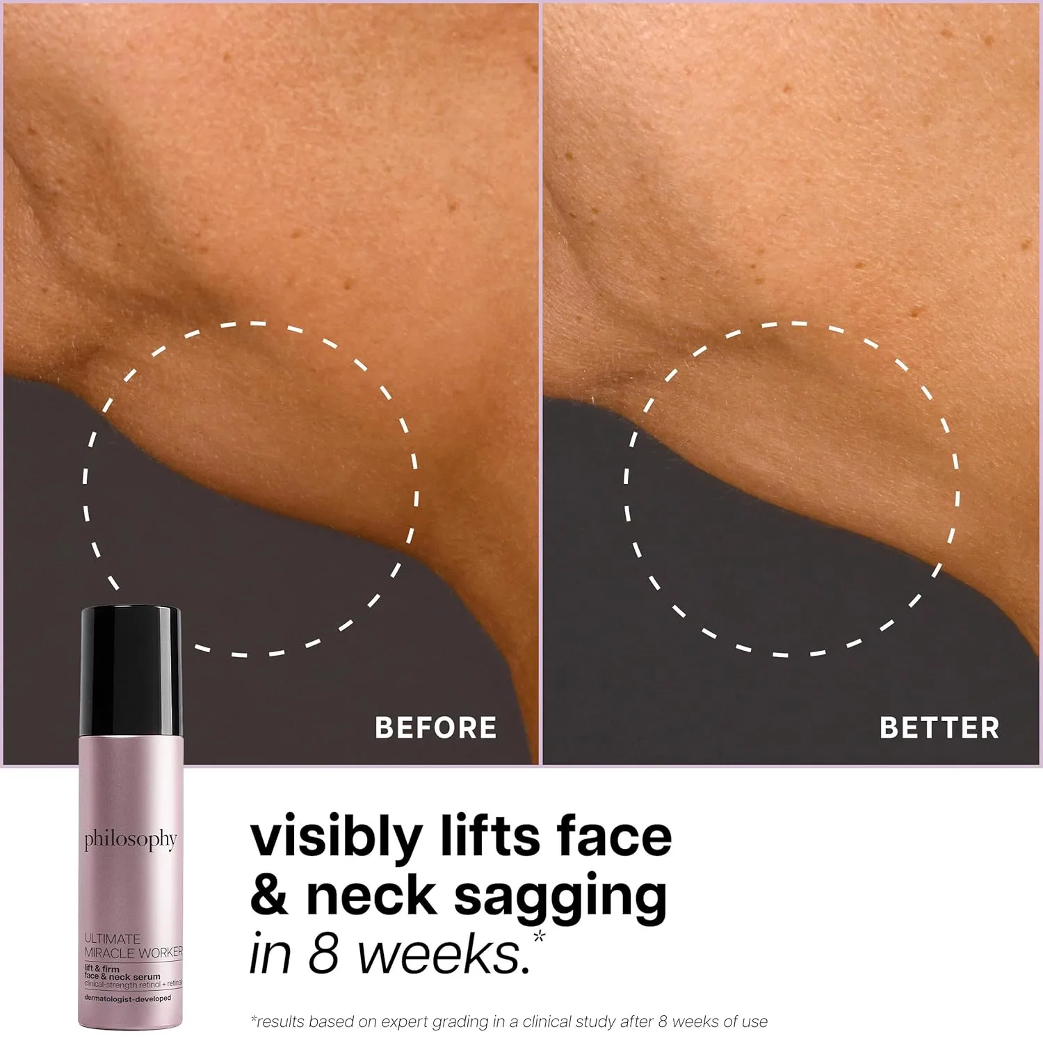 Сыворотка Philosophy — Ultimate Miracle Worker Lift & Firm Face & Heack Serum - с инкапсулированным ретинолом и — фото 4