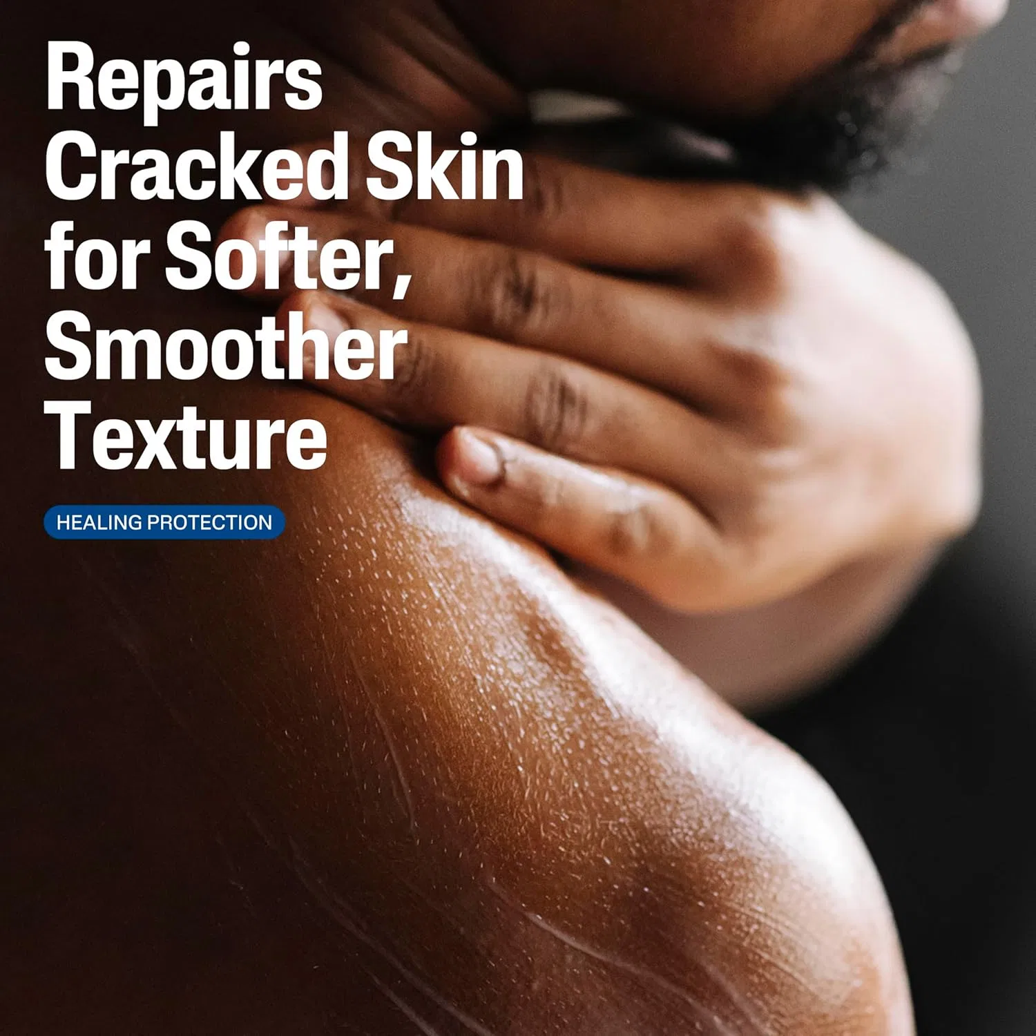 Лосьон для очень сухой и потрескавшейся кожи CETAPHIL Cracked Skin Repair Lotion 473 мл Cetaphil — фото 3