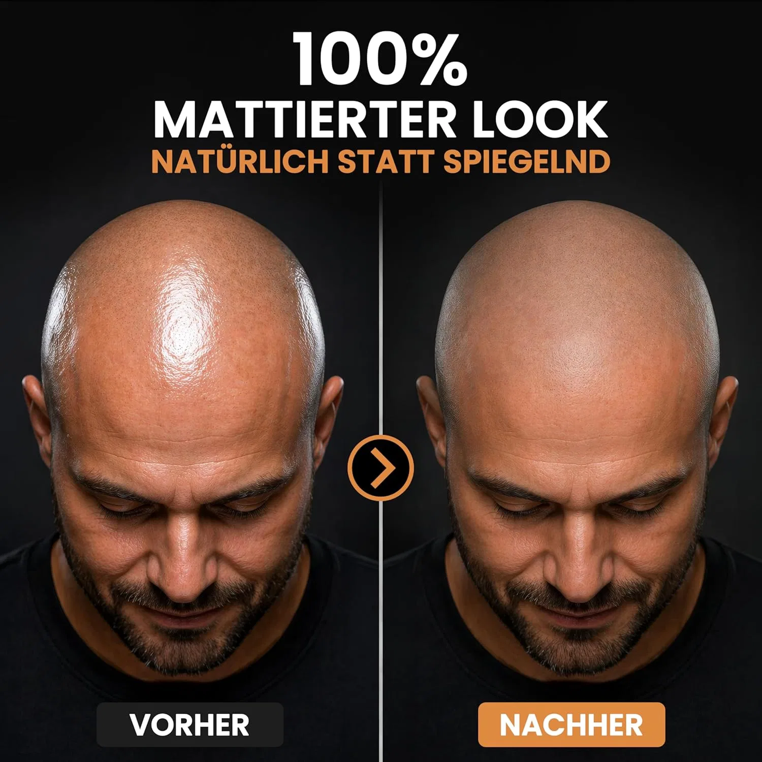Матирующий крем для кожи головы 2.0 Bald Care Matt Anti-Shine, 74 г Zero Shine — фото 3
