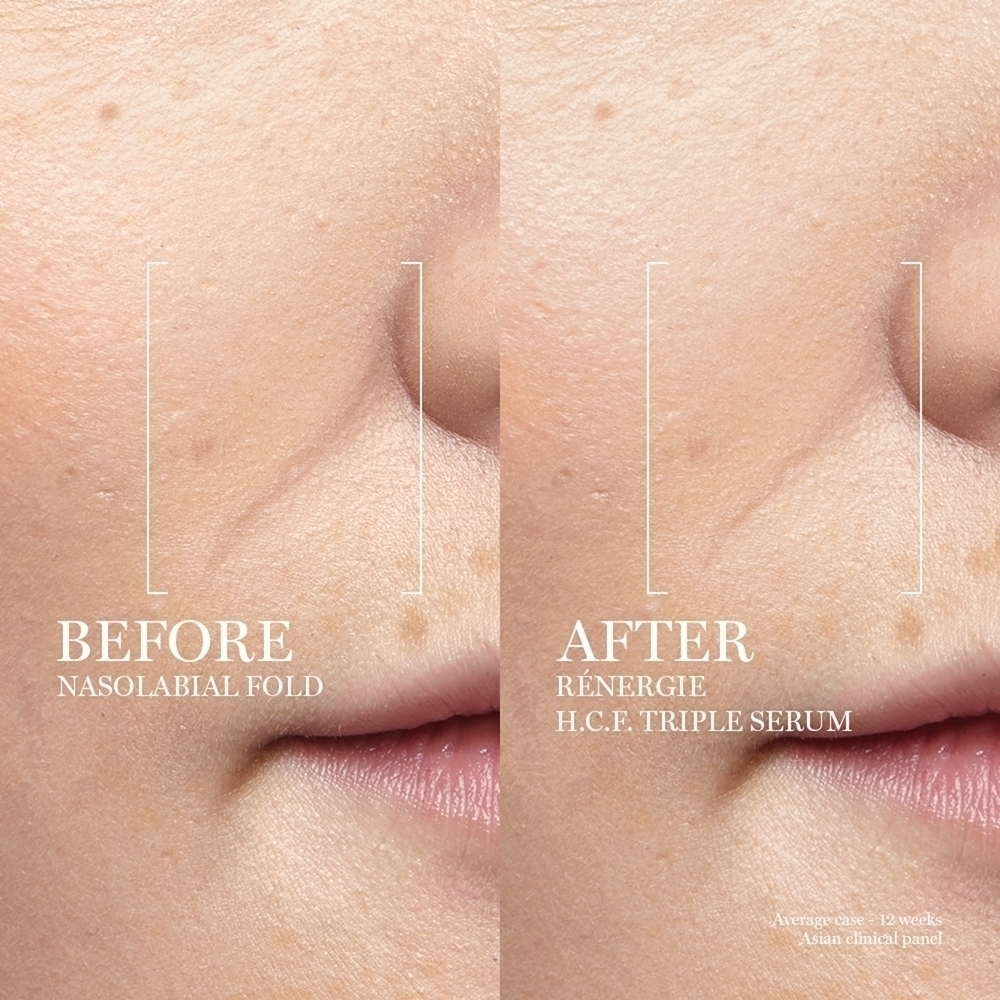 Сыворотка Lancôme — Для лица Rénergie hcf Triple Serum , moterims, 50 мл — фото 3
