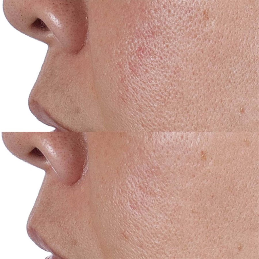 Тоник Perricone Md — Face finishing & firming toner , объем, 118 мл — фото 4