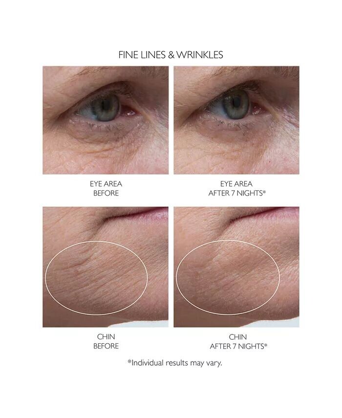 Сыворотка Peter Thomas Roth — Ночная Retinol Fusion PM, ,0 жидк. унция — фото 3