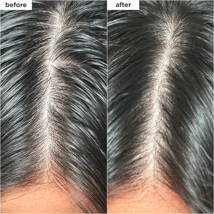 Сухой шампунь Scalp Revival с углем и биотином Briogeo, 1.7 oz/50 mL — фото 4