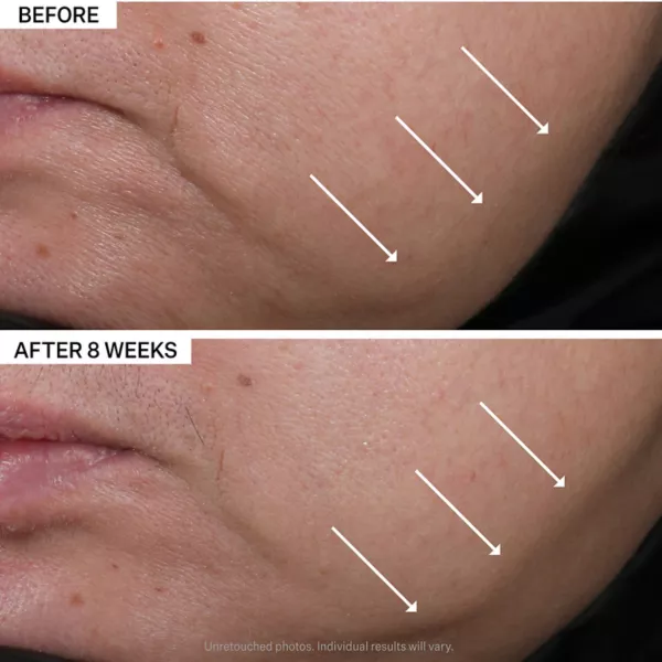 Крем для лица StriVectin — Contour restore подтягивающий и скульптурирующий увлажняющий — фото 3