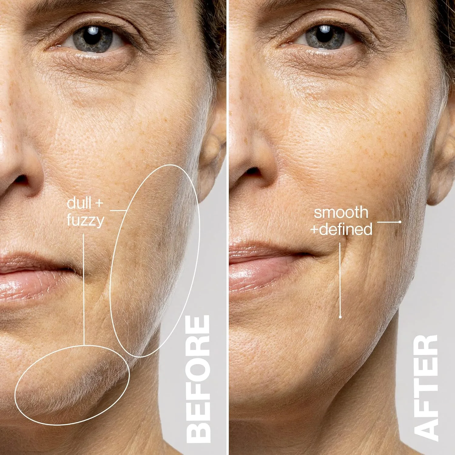 Инструмент для звуковой дермапланинга DERMAFLASH LUXE+ для удаления пушковых волос на лице, омоложения и отшелушивания., Seafoam — фото 4