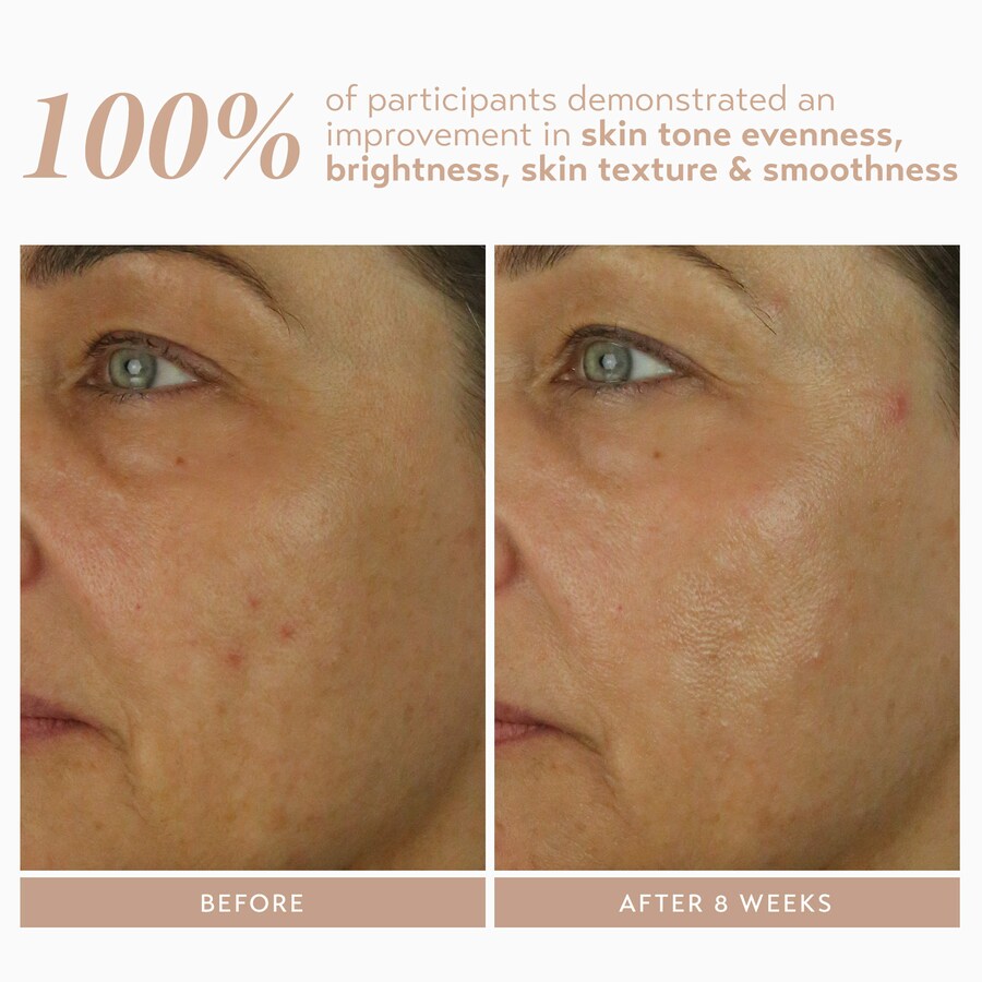 Сыворотка Shani Darden Skin Care — Retinol Reform с % инкапсулированного ретинола для борьбы с мелкими морщинами — фото 4