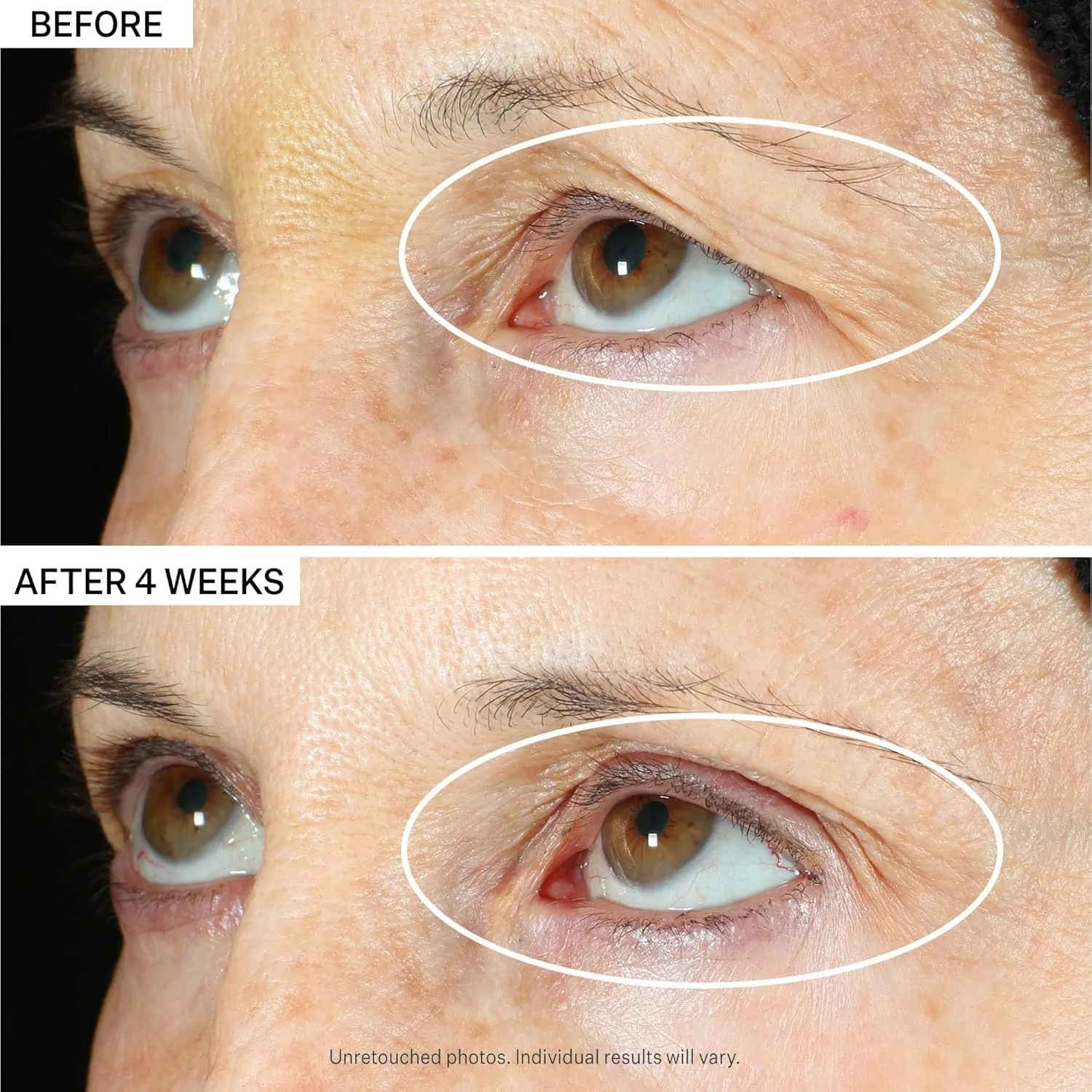 Сыворотка для глаз StriVectin Tighten & Lift Peptight 360 Degree Eye Serum и крем для шеи Tighten & Lift Advanced Neck Cream PLUS с альфа-3 пептидами для шеи и зоны декольте — фото 3