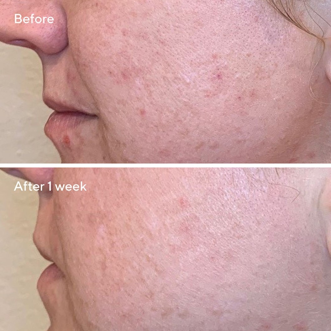 Сыворотка Murad — Для лица aha/bha/retinoid daily clarifying peel , объем, 95 мл — фото 4
