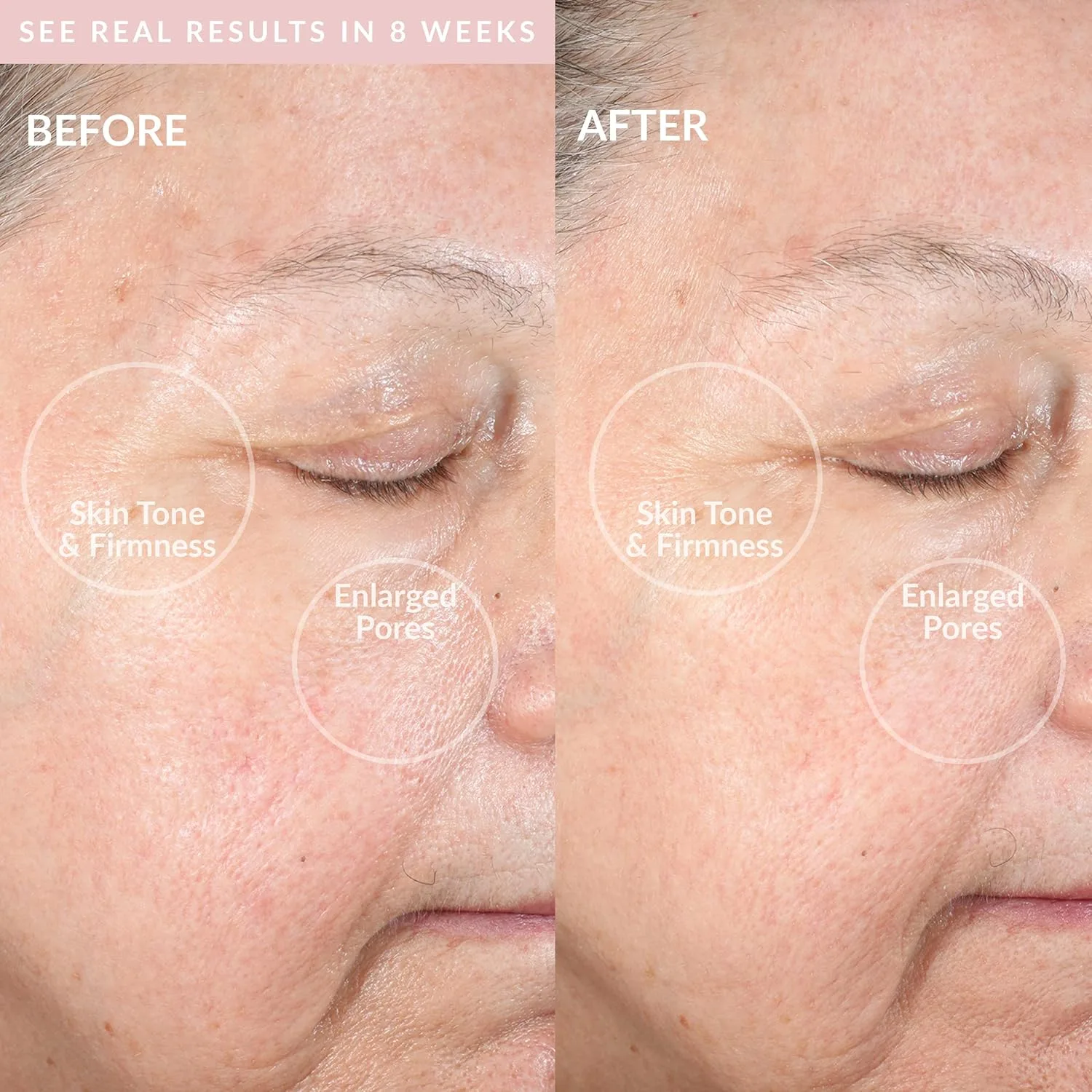 Clean Pro OB - Интеллектуальное устройство для очищения лица Pmd Beauty, Blush Rose Quartz + Starter — фото 4