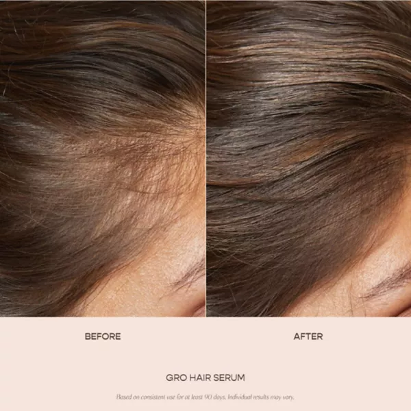 Набор сыворотки Gro Hair и жевательных конфет с биотином для истончения волос Vegamour — фото 2