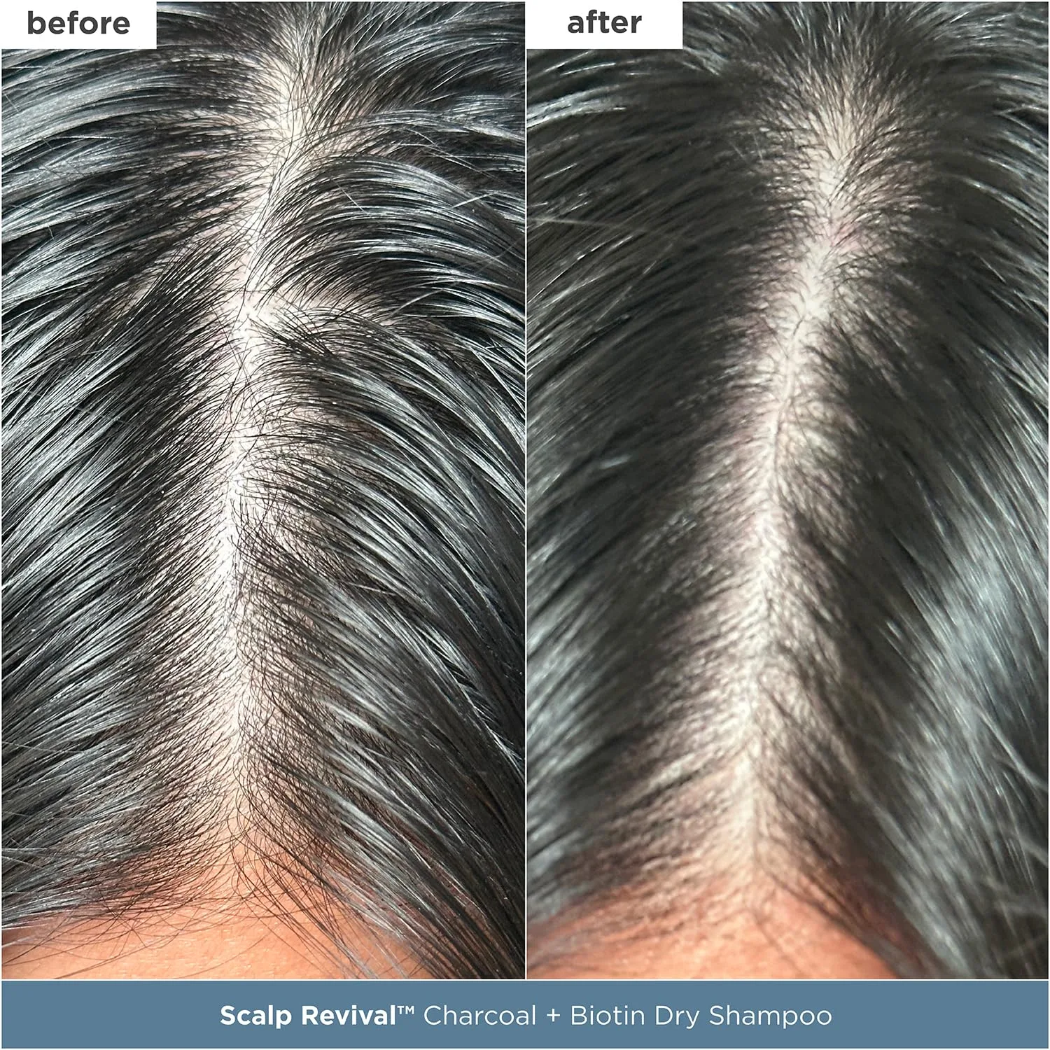Набор для ухода за кожей головы Briogeo Scalp Revival: детокс и увлажнение с углем и маслом чайного дерева, веганский, без жестокости 1 шт. — фото 3