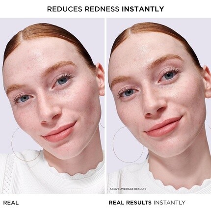 Сыворотка It Cosmetics — Bye Bye Redness Serum Успокаивающая кожу увлажняющая для лица 1 жидкая унция — фото 2