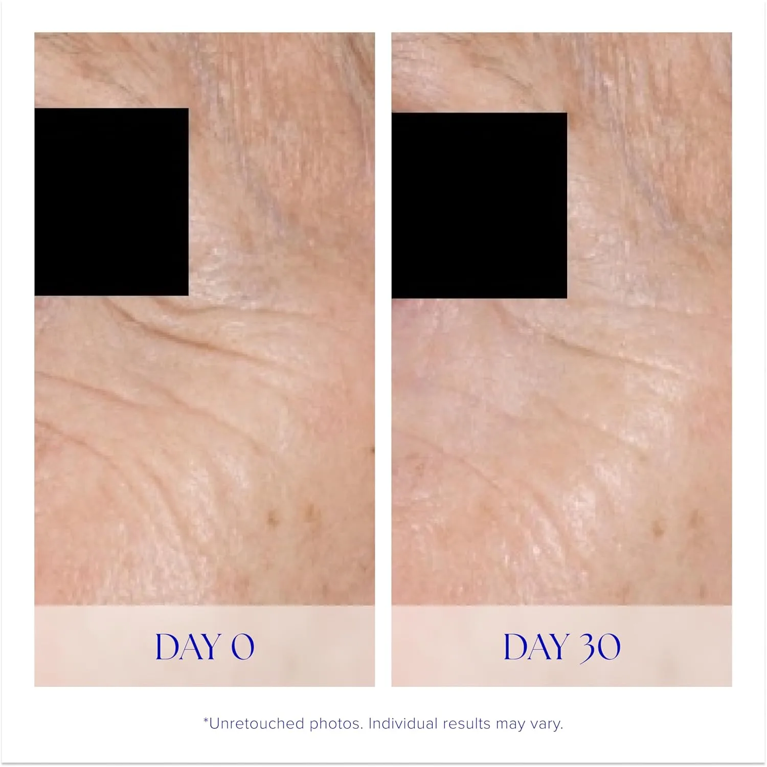 iS CLINICAL Youth Eye Complex, антивозрастной осветляющий крем для области вокруг глаз, уменьшает отечность, увлажняет и подтягивает кожу вокруг глаз. — фото 4